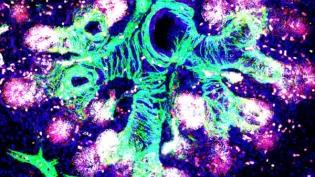 fetal_lung_Rawlins Lin