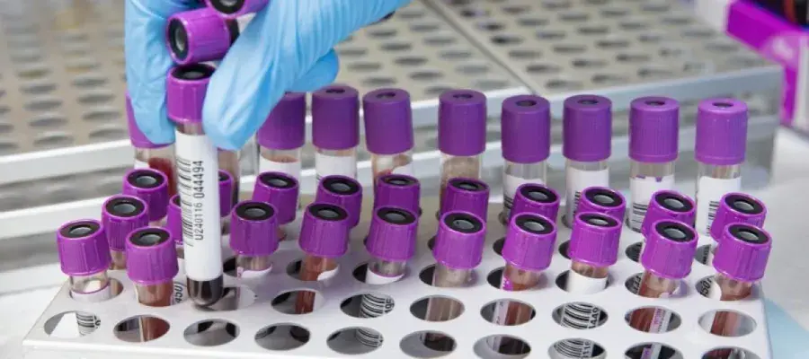 Blood samples in containers