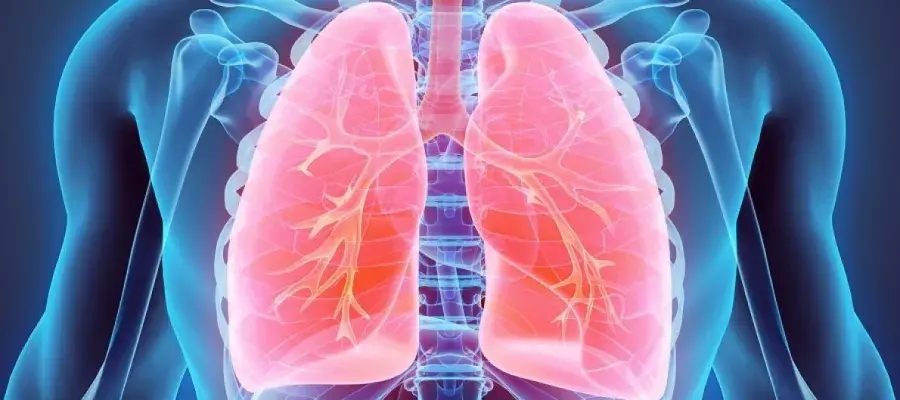 X-ray photo of lungs 