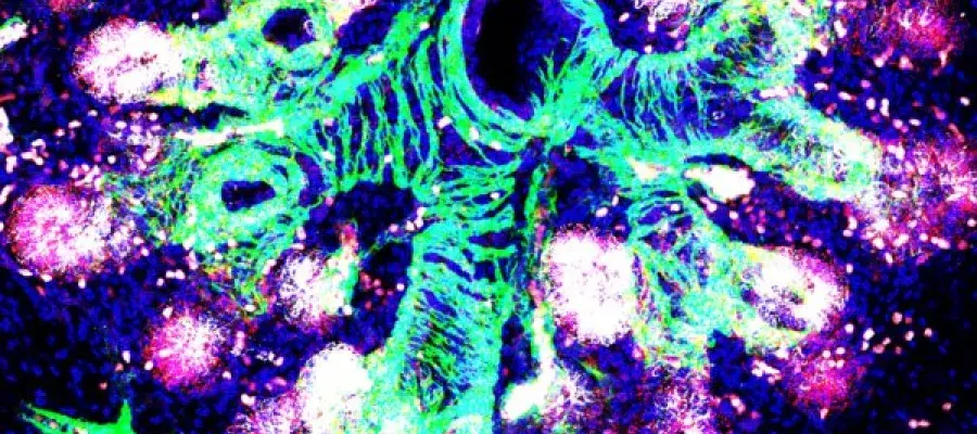 fetal_lung_Rawlins Lin
