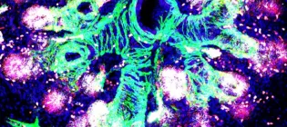 fetal_lung_Rawlins Lin