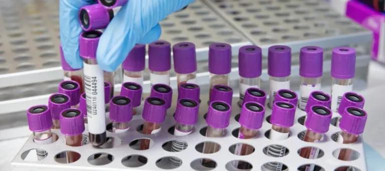 Blood samples in containers