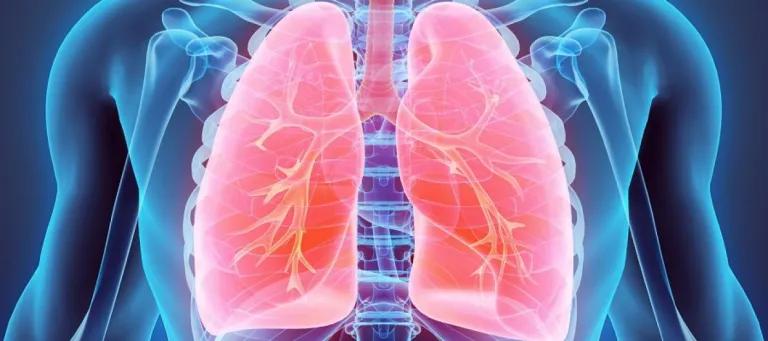 X-ray photo of lungs 